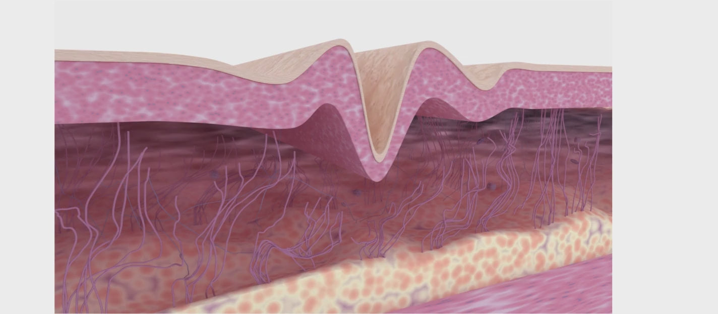 collagen video 