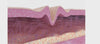 collagen video 